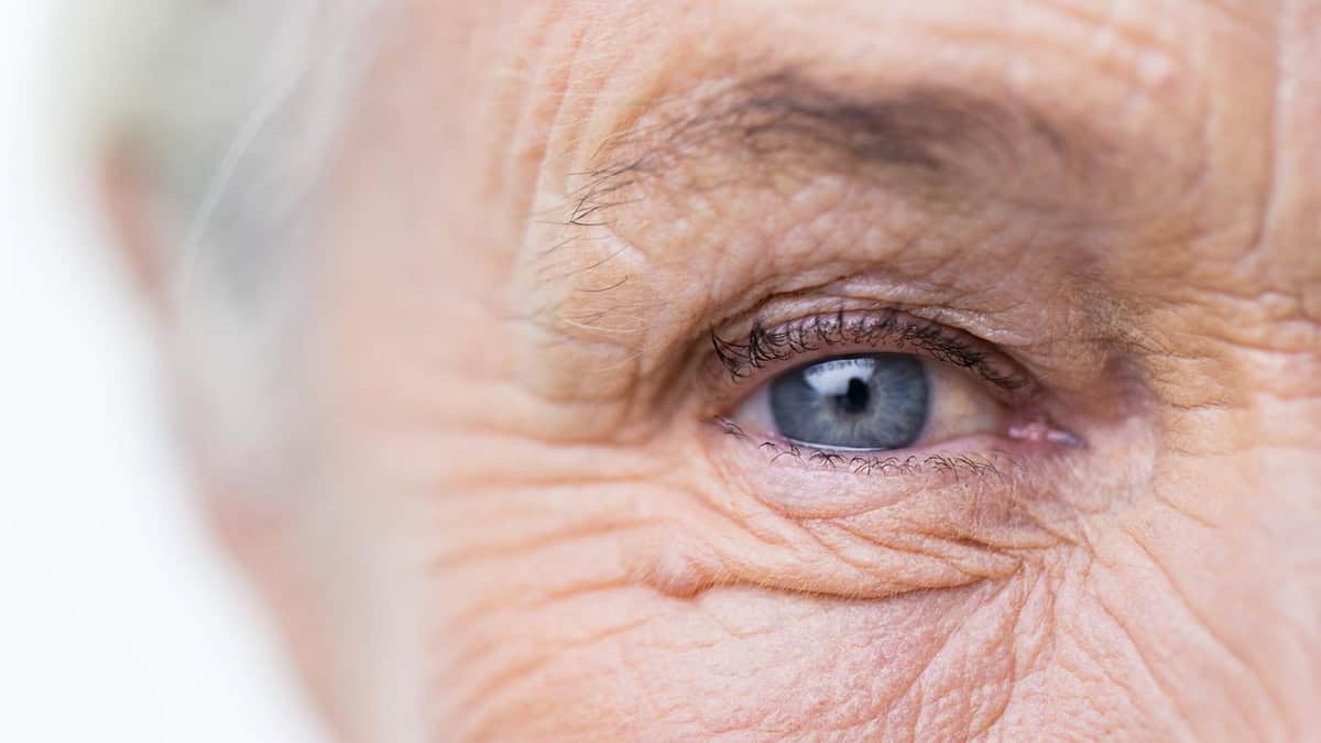 All About Glaucoma: Symptoms, Causes, and Treatment Options