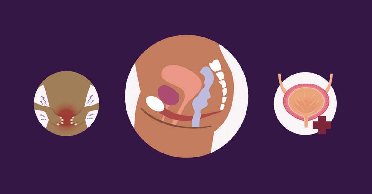 How the Pelvic Floor Works (and When You May Need Help to Relax or Strengthen It)